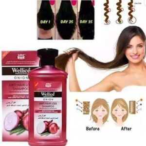 "Wellice Onion Anti Hair Loss Shampoo - Strengthening & Nourishing Formula for Thicker, Fuller Hair